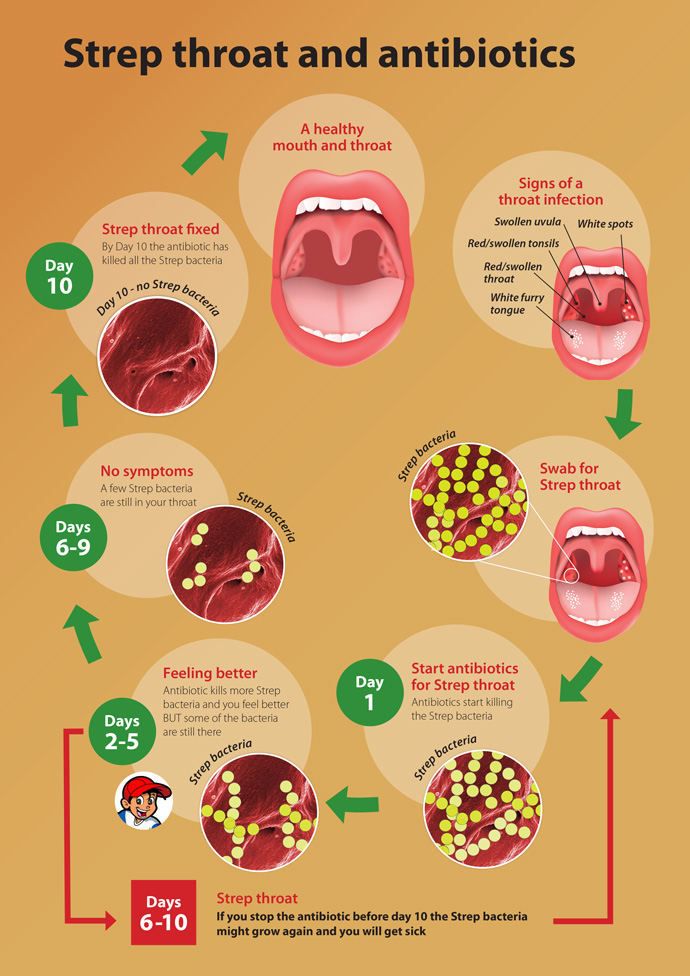 Strep And Antibiotics Stages 2 